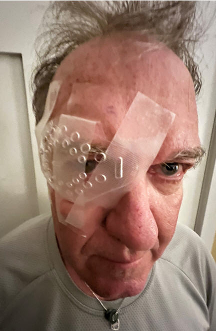 You should see what I did to the other guy! Uh, no, not really. This is a selfie I took the next morning after my cataract surgery. I’ll bet I know what you’re thinking: “Tim, I’ve never seen you look better.” Um, thanks.